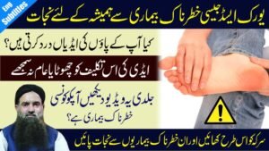 Get Rid of Uric Acid Problems Forever – Simple Vinegar Remedy for Heel Pain and Joint Health maxresdefault-77